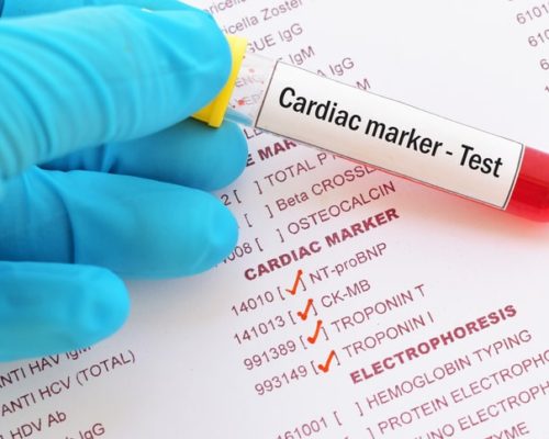 LAB TEST: Heart Assessment Tests
