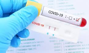 LAB TEST - Covid Tests