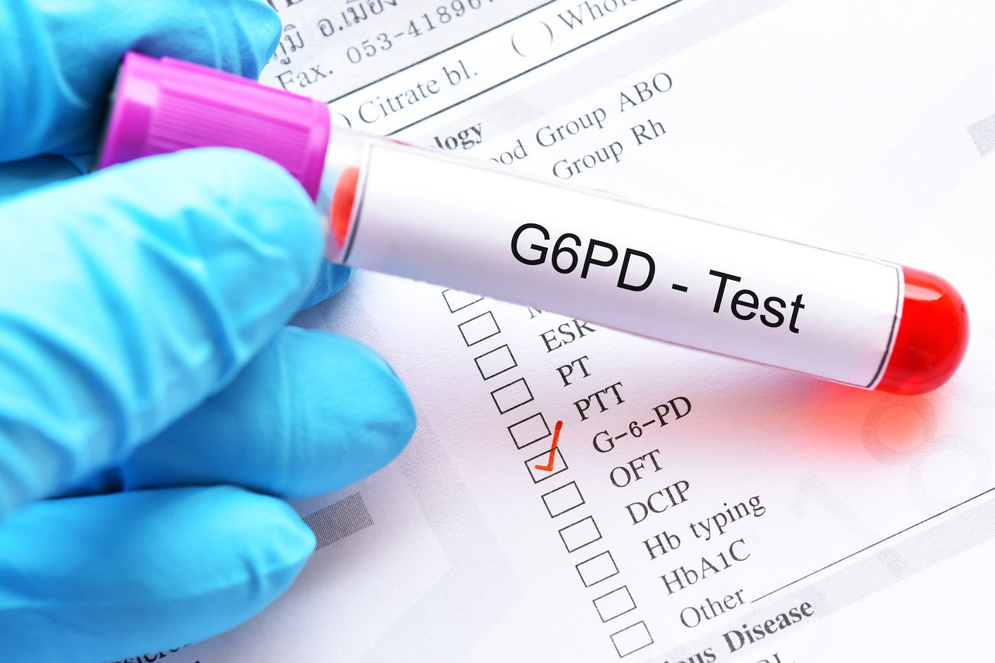 LAB TEST : Routine Blood Tests