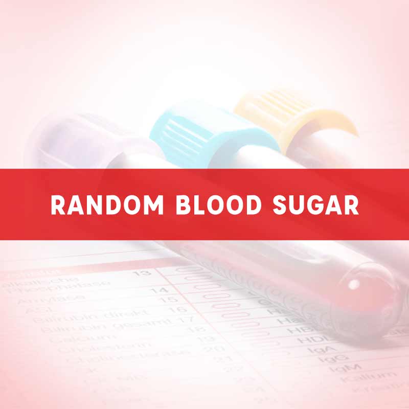 LAB TEST - Sugar Assessment Tests