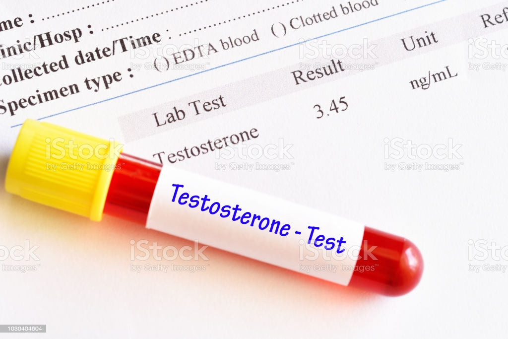 LAB TEST : Hormones