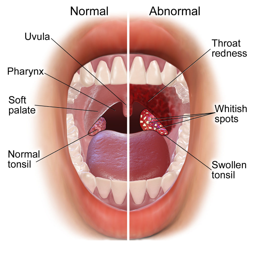 LAB TEST - Swab Tests for Infections