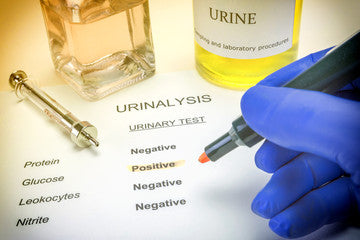 LAB TEST : Urine Examination Tests