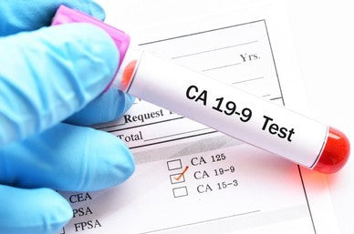 LAB TEST : Tumor/Cancer Markers Assessment