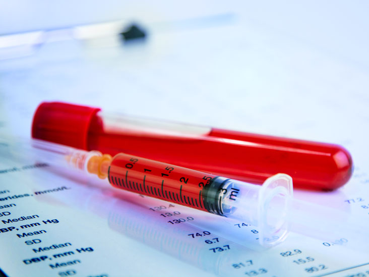 LAB TEST : Routine Blood Tests