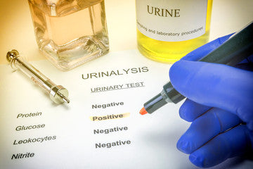 LAB TESTS : Kidney Function Assessment Test