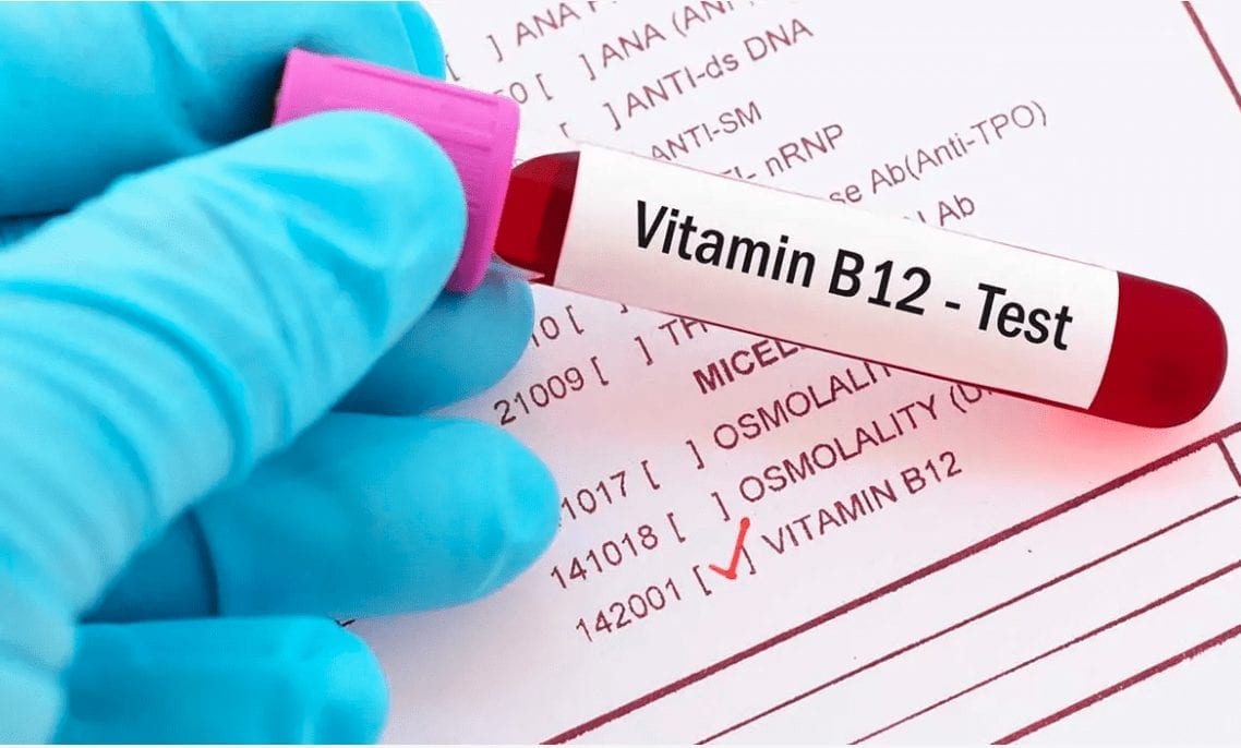 LAB TEST: Vitamin Assessment