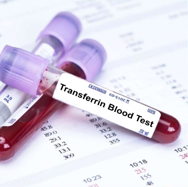 LAB TEST: Anaemia Assessment