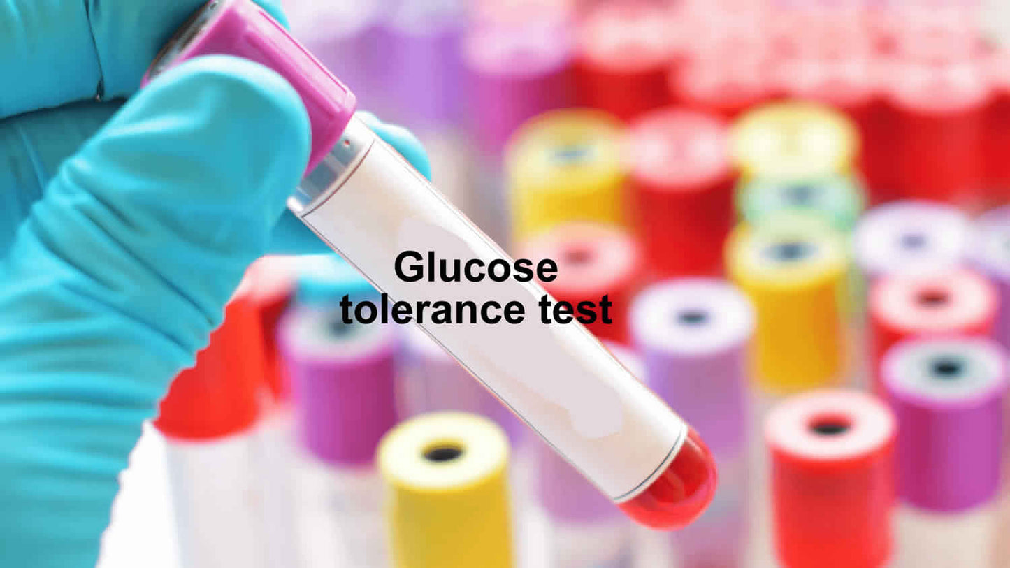 LAB TEST - Sugar Assessment Tests