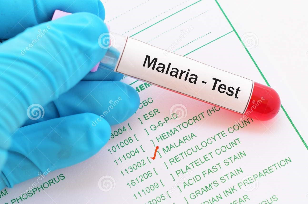 LAB TEST : Malaria Tests
