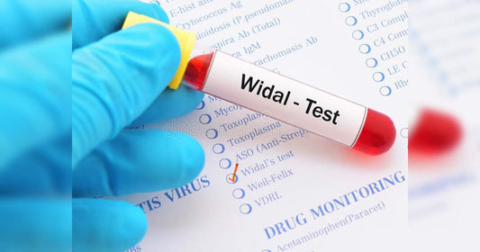 LAB TEST : Typhoid Tests